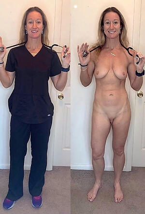 Before And After Pics